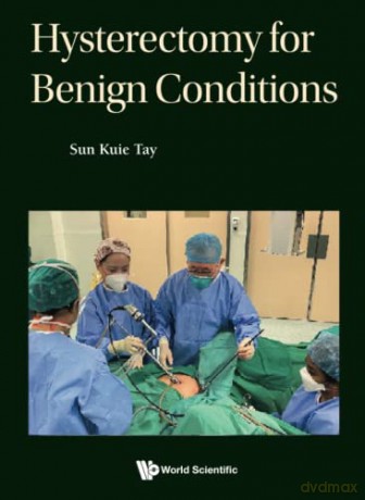 Hysterectomy For Benign Conditions - Sun Kuie Tay [KSIĄŻKA]