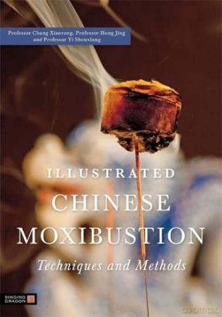 Illustrated Chinese Moxibustion Techniques and Methods - Professor Hong Jing and Professor Yi Shouxiang Professor Chang Xiaorong [KSIĄŻKA]