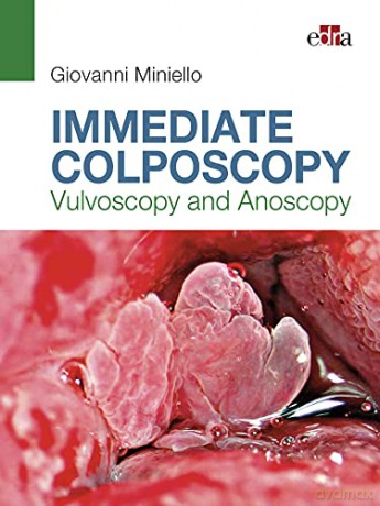 Immediate Colposcopy - Vulvoscopy and Anoscopy - Giovanni Miniello [KSIĄŻKA]