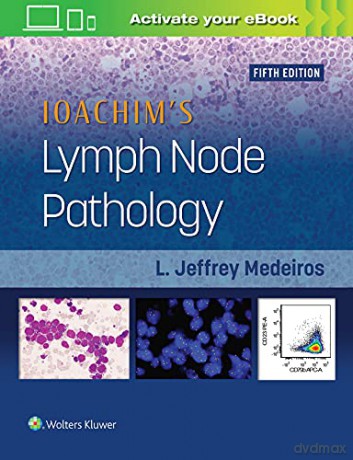 Ioachim's Lymph Node Pathology - L. Jeffrey Medeiros [KSIĄŻKA]