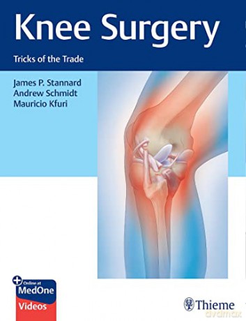Knee Surgery: Tricks of the Trade - James P. Stannard: Andrew H. Schmidt: Mauricio Kfuri [KSIĄŻKA]