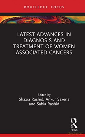 Latest Advances in Diagnosis and Treatment of Women-Associated Cancers - Shazia Rashid [KSIĄŻKA]
