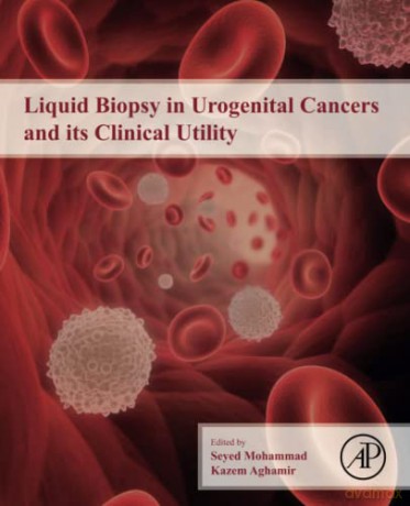 Liquid Biopsy in Urogenital Cancers and its Clinical Utility - Seyed Mohammad Kazem Aghamir [KSIĄŻKA]