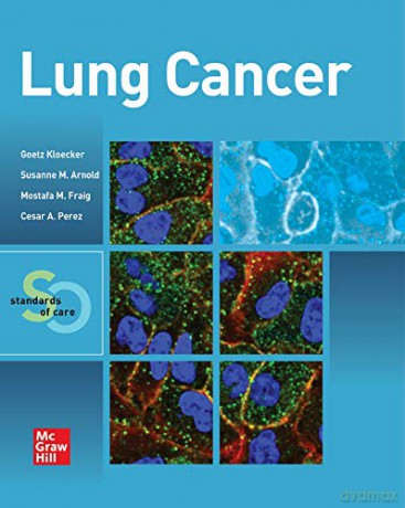 Lung Cancer: Standards of Care (HEMATOLOGY/ONCOLOGY) - Cesar A. Perez [KSIĄŻKA]
