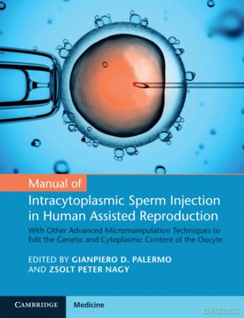 Manual of Intracytoplasmic Sperm Injection in Human Assisted Reproduction: With Other Advanced Micromanipulation Techniques to Edit the Genetic and Cytoplasmic Content of the Oocyte - Gianpiero D. Palermo [KSIĄŻKA]