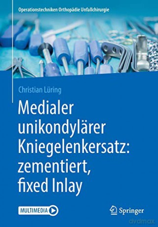 Medialer unikondylärer Kniegelenkersatz: zementiert (Operationstechniken Orthopädie Unfallchirurgie) - Christian Lüring [KSIĄŻKA]