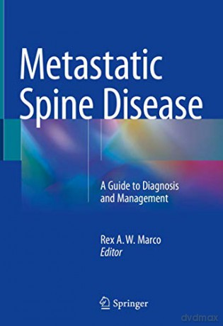Metastatic Spine Disease: A Guide to Diagnosis and Management - Rex A. W. Marco [KSIĄŻKA]