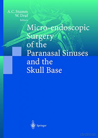 Micro-endoscopic Surgery of the Paranasal Sinuses and the Skull Base - Aldo C. Stamm [KSIĄŻKA]