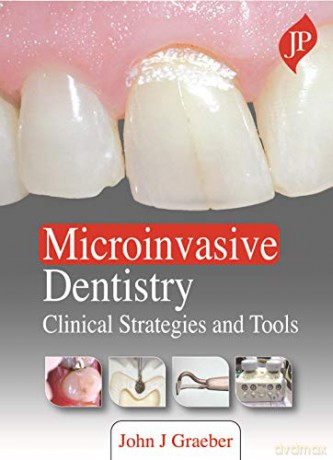 Microinvasive Dentistry: Clinical Strategies and Tools - John J Graeber [KSIĄŻKA]