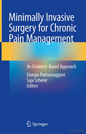 Minimally Invasive Surgery for Chronic Pain Management: An Evidence-Based Approach - Giorgio Pietramaggiori [KSIĄŻKA]