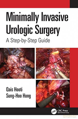 Minimally Invasive Urologic Surgery: A Step-by-Step Guide - Qais Hooti [KSIĄŻKA]