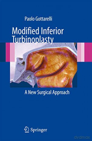 Modified Inferior Turbinoplasty: A new surgical approach - Paolo Gottarelli [KSIĄŻKA]