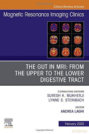 MR Imaging of the Bowel, An Issue of Magnetic Resonance Imaging Clinics of North America (Volume 28-1) (The Clinics: Radiology, Volume 28-1) - Andrea Laghi [KSIĄŻKA]