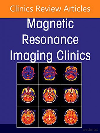 MR Imaging of The Knee, An Issue of Magnetic Resonance Imaging Clinics of North America (Volume 30-2) (The Clinics: Internal Medicine, Volume 30-2) - MK Jesse MD [KSIĄŻKA]