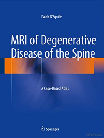 MRI of Degenerative Disease of the Spine: A Case-Based Atlas - Paola D'Aprile [KSIĄŻKA]
