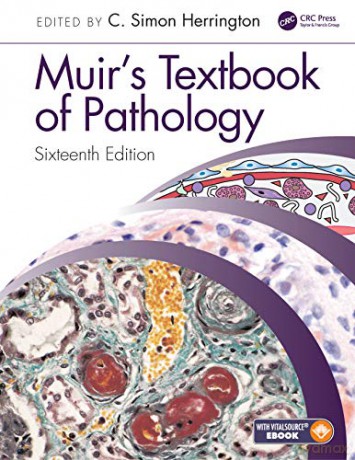 Muir's Textbook of Pathology: Sixteenth Edition International Student Edition - C. Simon Herrington [KSIĄŻKA]
