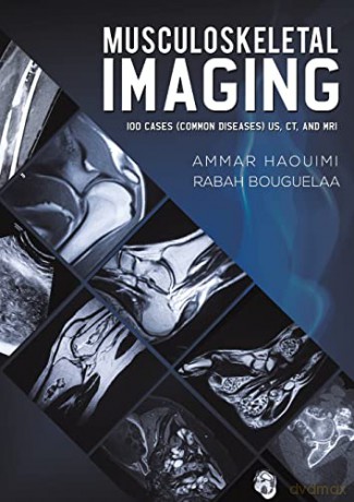 Musculoskeletal Imaging: 100 Cases (Common Diseases) US, CT and MRI - Rabah Bouguelaa [KSIĄŻKA]
