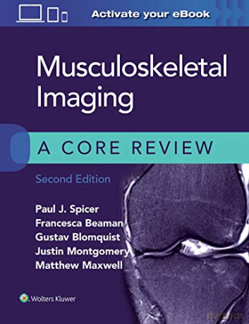 Musculoskeletal Imaging: A Core Review - Paul Spicer [KSIĄŻKA]