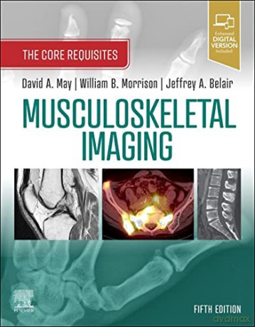 Musculoskeletal Imaging: The Core Requisites - David A. May MD [KSIĄŻKA]