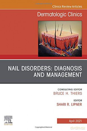 Nail Disorders: Diagnosis and Management, An Issue of Dermatologic Clinics (Volume 39-2) (The Clinics: Internal Medicine, Volume 39-2) - Shari Lipner MD PhD [KSIĄŻKA]
