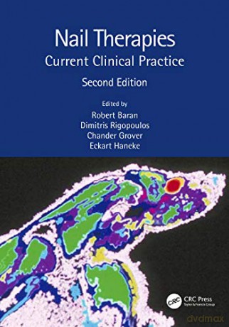Nail Therapies: Current Clinical Practice - Dimitris Rigopoulos [KSIĄŻKA]