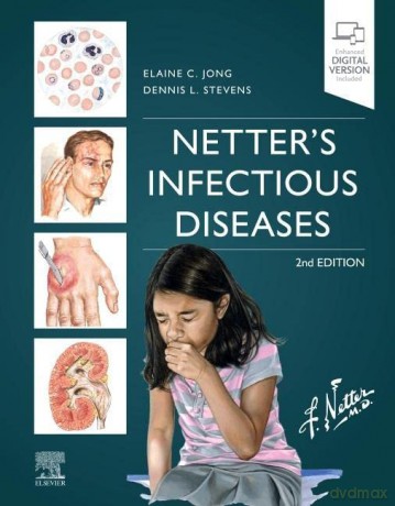 Netter's Infectious Diseases - Elaine C. Jong MD FIDSA FASTMH [KSIĄŻKA]