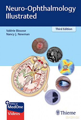 Neuro-Ophthalmology Illustrated - Valerie Biousse [KSIĄŻKA]