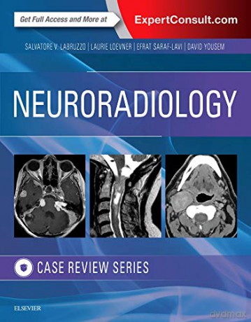 Neuroradiology Imaging Case Review, 1e - Salvatore V. Labruzzo DO [KSIĄŻKA]