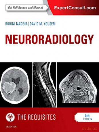 Neuroradiology: The Requisites, 4e (Requisites in Radiology) - Rohini Nadgir MD [KSIĄŻKA]