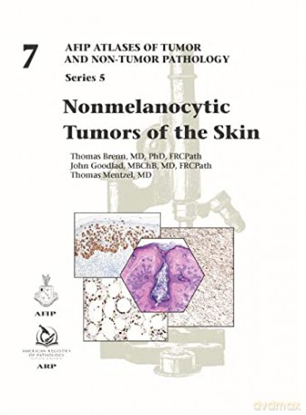 Nonmelanocytic Tumors of the Skin (AFIP Atlas of Tumor and Non-Tumor Pathology, Series 5) - Thomas Brenn [KSIĄŻKA]