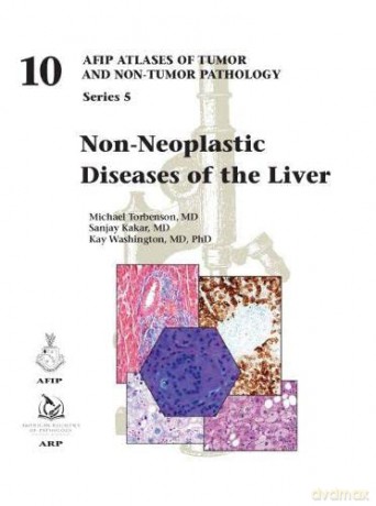 Non-Neoplastic Diseases of the Liver (AFIP Atlas of Tumor and Non-Tumor Pathology, Series 5) - Michael Torbenson [KSIĄŻKA]