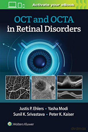 OCT and OCTA in Retinal Disorders - Justis P. Ehlers [KSIĄŻKA]