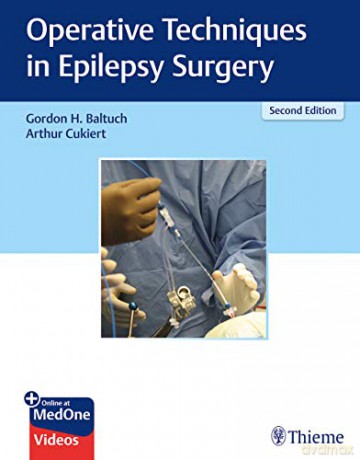 Operative Techniques in Epilepsy Surgery - Gordon H. Baltuch [KSIĄŻKA]