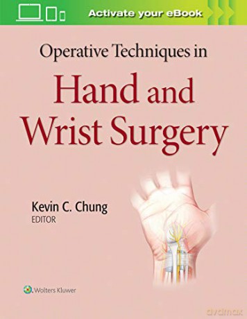 Operative Techniques in Hand and Wrist Surgery - Kevin C Chung MD MS [KSIĄŻKA]