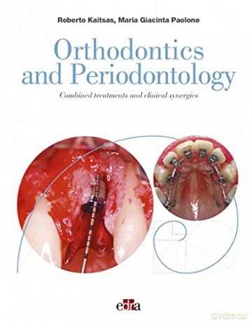 Orthodontics and Periodontology - Roberto Kaitsas [KSIĄŻKA]