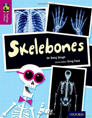 Oxford Reading Tree TreeTops inFact: Level 10: Skelebones - Ranj Singh [KSIĄŻKA]