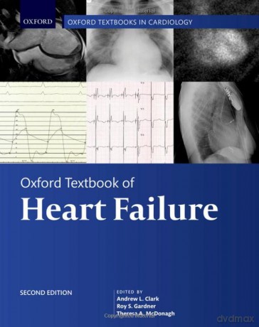 Oxford Textbook of Heart Failure (Oxford Textbooks in Cardiology) - Andrew L. Clark [KSIĄŻKA]