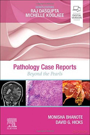 Pathology Case Reports: Beyond the Pearls - Monisha Bhanote MD FCAP ABOIM [KSIĄŻKA]