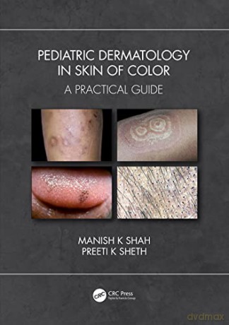 Pediatric Dermatology in Skin of Color: A Practical Guide - Manish K Shah [KSIĄŻKA]