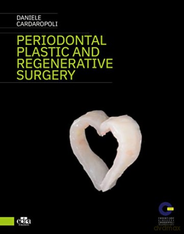Periodontal Plastic and Regenerative Surgery - Daniele Cardaropoli [KSIĄŻKA]