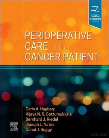 Perioperative Care of the Cancer Patient - Carin A. Hagberg MD FASA [KSIĄŻKA]