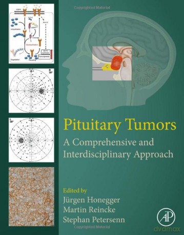 Pituitary Tumors: A Comprehensive and Interdisciplinary Approach - Jürgen Honegger [KSIĄŻKA]