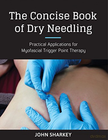 The Concise Book of Dry Needling: A Practitioner's Guide to Myofascial Trigger Point Applications - John Sharkey [KSIĄŻKA]