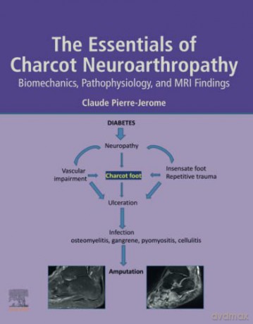 The Essentials of Charcot Neuroarthropathy: Biomechanics, Pathophysiology, and MRI Findings - Pierre-Jerome [KSIĄŻKA]