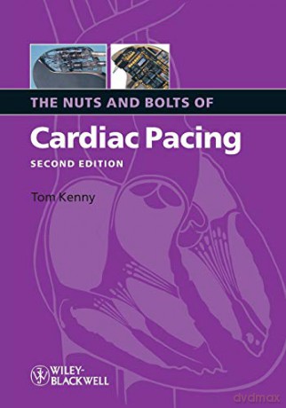 The Nuts and Bolts of Cardiac Pacing (Nuts and Bolts Series) (Nuts and Bolts Series (Replaced by 5113)) - Kenny [KSIĄŻKA]
