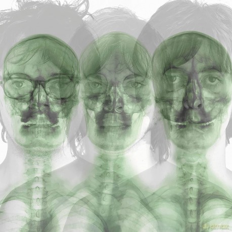 Supergrass: Supergrass (Black Heavy Weight) [2xWinyl]