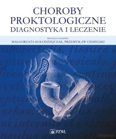 Choroby proktologiczne - Małgorzata Kołodziejczak, Przemysław Ciesielski [KSIĄŻKA]