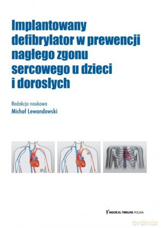 Implantowany defibrylator w prewencji nagłego zgonu sercowego u dzieci i dorosłych [KSIĄŻKA]