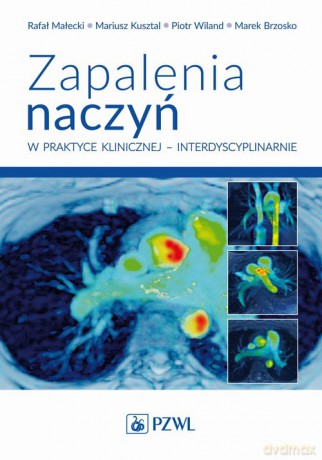 Zapalenia naczyń w praktyce klinicznej interdyscyplinarnie - Rafał Małecki, Mariusz Kusztal [KSIĄŻKA]