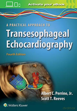 A Practical Approach to Transesophageal Echocardiography - Albert C. Perrino [KSIĄŻKA]
